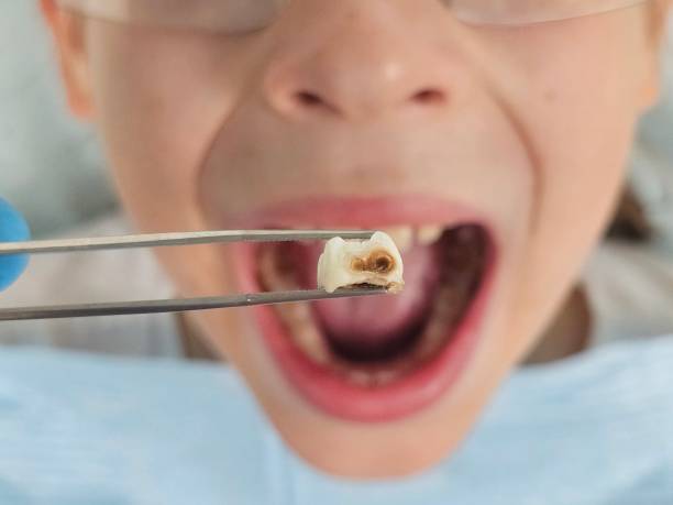 Best Emergency Orthodontic Services in Petersburg, IN